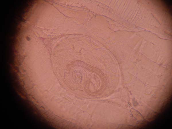Imaxe de microscopio da larva da Trichinella, dentro do quiste de carbonato cálcico que a protexe./ Foto: Clínica Veterinaria Valcán.