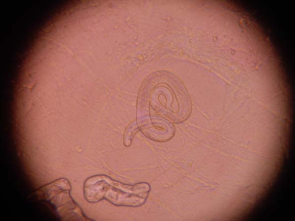 Unha das larvas de Trichinella da mostra de carne analizada no Barco./ Foto: Clínica Valcán.